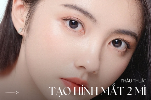 Phẫu thuật tạo hình mắt 2 mí